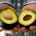 avocadoletsel avocadohand letselschade advocaat amsterdam